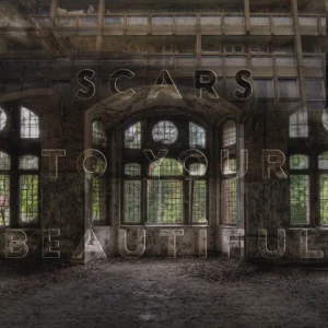 SF1118088-Alessia-Cara-Scars-To-Your-Beautiful